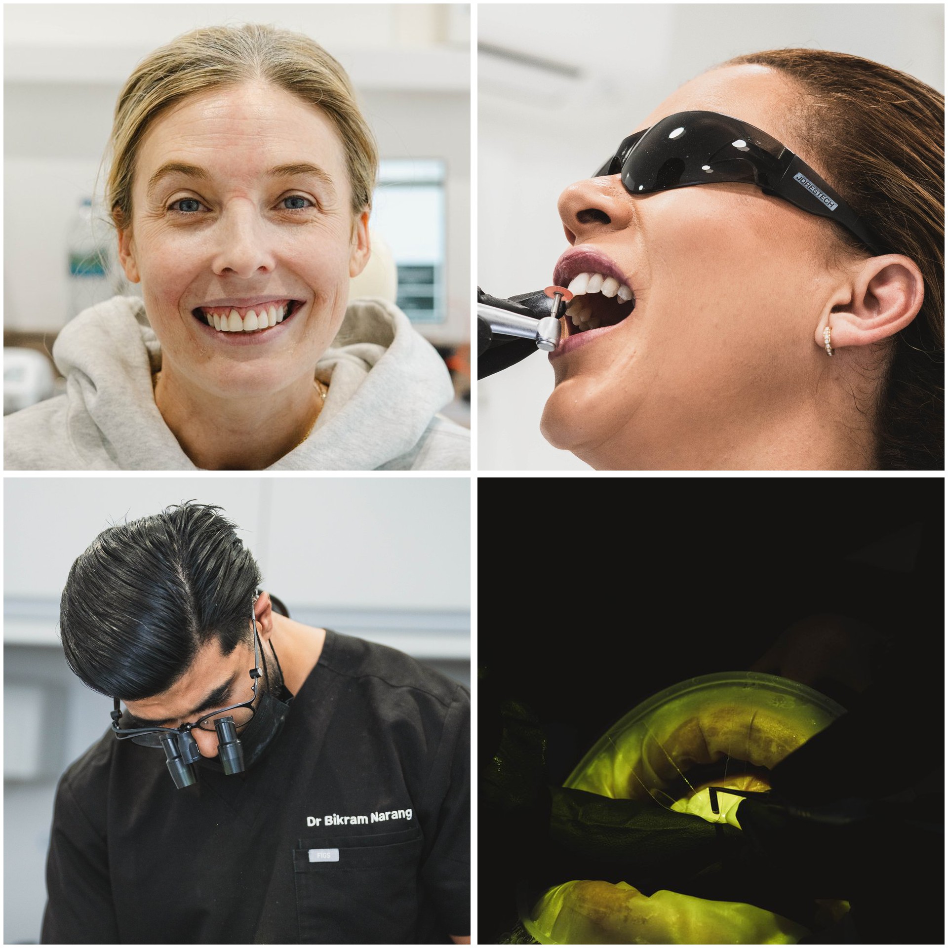dental-bridge 2